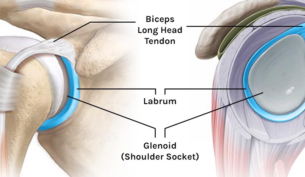 What is a Labrum Tear? - Tom Morrison