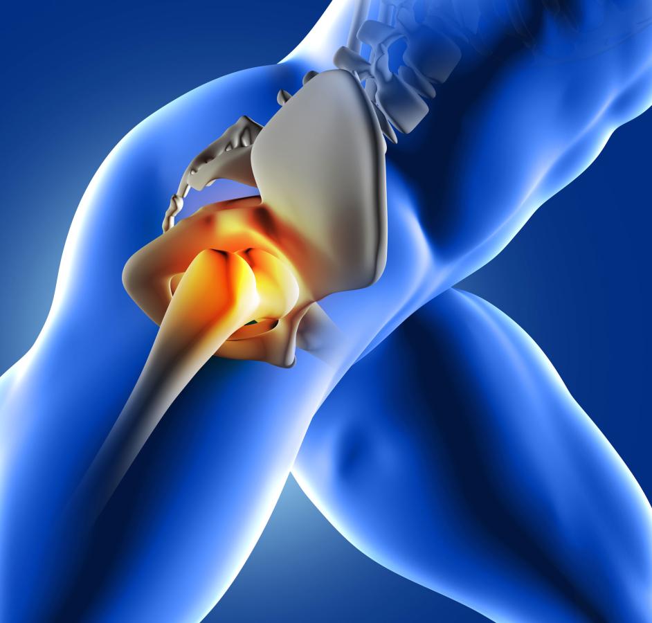 How to Stop Hip Impingement - Tom Morrison