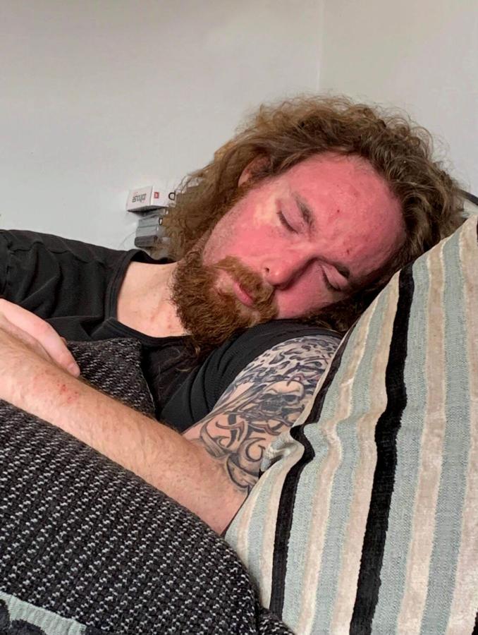 Exercising with Extreme Fatigue - Tom Morrison