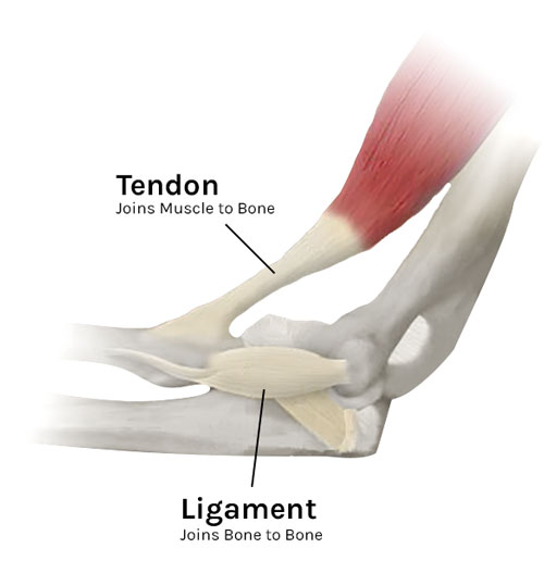 How to stop Tendonitis - Tom Morrison