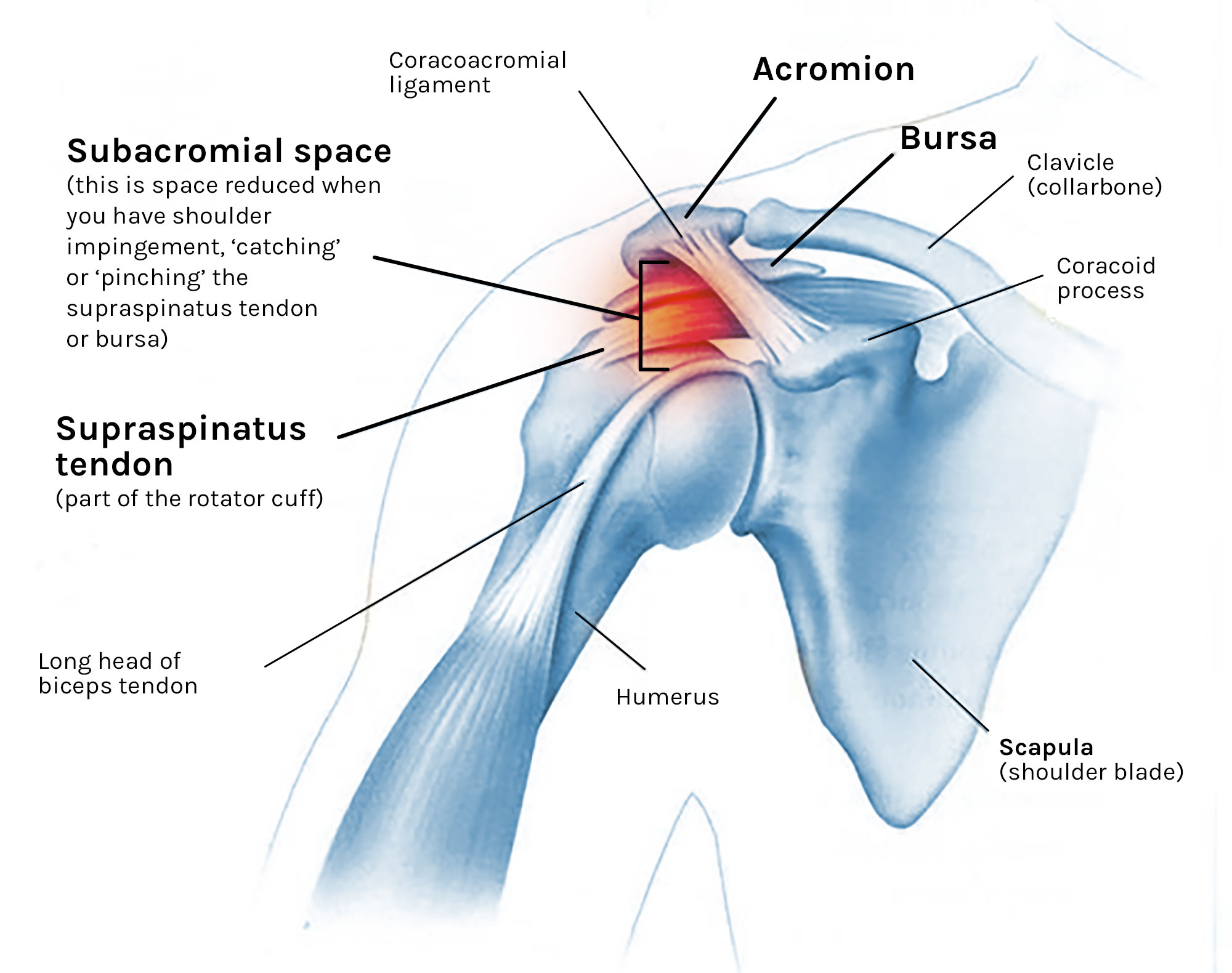 Shoulder Ligament Anatomy Diagram Shoulder Impingemen - vrogue.co